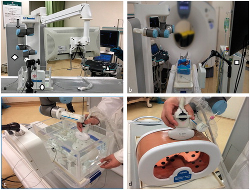 Figure 1. (a) and (b) show the robot designed by our team including the ultrasound unit (△), the electromagnetic sensor (○), the robotic arm (↓), microwave ablation unit (□), the controller (◇) and screens. c, d show the rigid body and phantom body model with a respiratory simulation device.