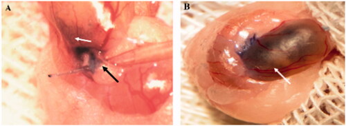 Figure 4. Cells transplantation into seminiferous tubules. The cell suspension was injected into seminiferous tubules through the efferent duct using a fine microinjection needle (A). ∼70–90% of seminiferous tubules were filled in each recipient testis. (B) Seminiferous tubules are shown by the white arrow, and the efferent duct is indicated by black arrow.