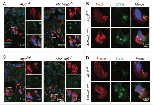 Figure 5. TBCs distribution rather than assembly is affected in the autophagy-deficient Sertoli cells. (A and C) The distribution of TBCs was perturbed in AMH-atg5−/−and AMH-atg7−/−mouse testes. (A) Immunofluorescence analysis of phalloidin (red, labeled by TRITC) and CTTN (green) was performed in the testes of Atg5Flox/Floxmice (left panels) and AMH-atg5−/− mice (right panels). (C) The same immunofluorescence analysis as in (A) but conducted here with Atg7Flox/Floxmice (left panels) and AMH-atg7−/− mice (right panels). Nuclei were stained with DAPI (blue). (B and D) Abnormal TBCs distribution in AMH-atg5−/−and AMH-atg7−/−spermatids attached with some Sertoli cell regions. (B) Immunofluorescence analysis of phalloidin (red, labeled by TRITC) and CTTN (green) was performed in spermatids attached with some Sertoli cell regions of Atg5Flox/Flox(upper panels) and AMH-atg5−/−mice (lower panels). (D) The same immunofluorescence analysis as in (B) but conducted here with Atg7Flox/Flox(upper panels) and AMH-atg7−/−mice (lower panels). Nuclei were stained with DAPI (blue). See also Figure S6.