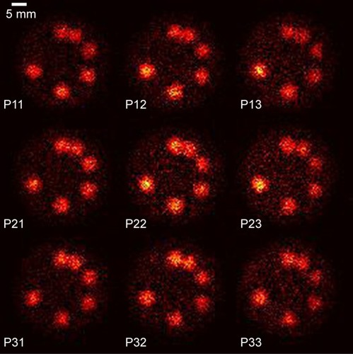 Figure 7 Projection for phantom (I).Note: Results are shown for the XFCT setup with a multi-pinhole size of 2 mm, 100 billion particles and a one-sided detector.Abbreviation: XFCT, X-ray fluorescence computed tomography.