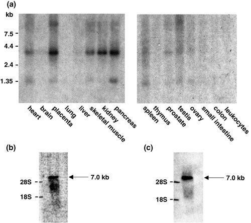Figure 3. Specific expression of GLUT11 in human tissues. (a) Northern blots with mRNA from the indicated human tissues were hybridized as described with a cDNA probe of human GLUT11 (bp 1–624 and bp 952–1608; GenBank accession no. AJ271290). (b) Northern blot with the RNA of mouse heart was hybridized with a probe of the GLUT11 cDNA fragment 626–951 containing the α-MHC motif. (c) Northern blot with the RNA of mouse heart was hybridized with a probe corresponding to an EST of α-MCH (GenBank accession no. AA445445).