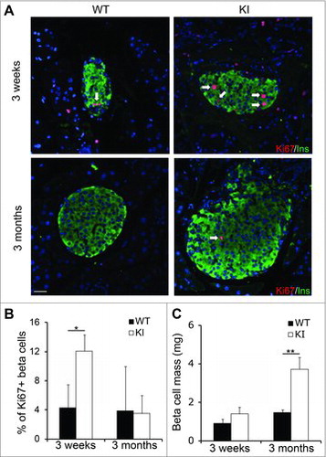 Figure 2. Overexpression of cyclin D2 increases β cell proliferation and β cell mass. (A) Representative immunofluorescence staining for insulin (green), Ki67 (red), and DAPI (blue). White arrows indicate Ins+Ki67+ cells. (B) Quantification of the percentage of β cells expressing Ki67 in WT and KI mice at 3 weeks and 3 months of age. (C) Quantification of β cell mass in WT and KI mice at 3 weeks and 3 months of age. Data shown as mean ± SD (n = 3–4 mice per group). *P < 0.05, **P < 0.01.