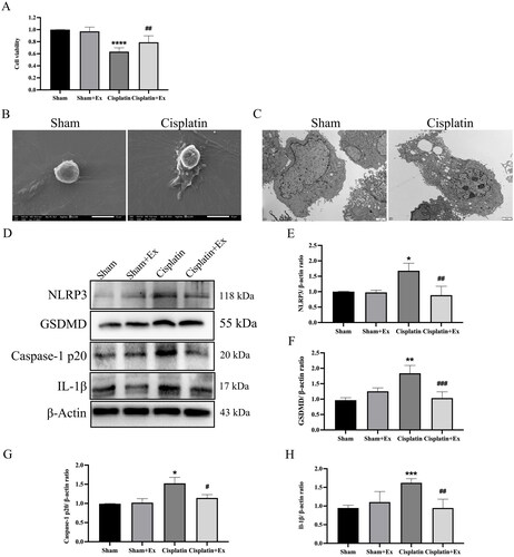 Figure 7. HucMSC-Ex inhibit renal pyroptosis in vitro. (A) NRK-52E cells were treated with 1 µg/mL cisplatin and 160 µg/mL hucMSC-Ex, and cell viability was detected by using CCK-8. (B) Representative scanning electron micrographs of pyroptosis in NRK-52E cells. (C) Representative transmission electron microscopes of pyroptosis in NRK-52E cells. (D–H) Western blot analysis of NLRP3, GSDMD, caspase-1 p20, and IL-1β expression (n = 3). The values are presented as the mean ± SD. *p < 0.5, **p < 0.1, ***p < 0.01 vs. sham group; #p < 0.5, ##p < 0.1, ###p < 0.01 vs. IRI group. Sham + Ex: Sham + hucMSC-Ex, IRI + Ex: IRI + hucMSC-Ex.