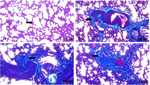 Figure 9. (A–D) Light photomicrograph of sections from maternal lung of control (A) and GAE received group (B–D) stained with Masson’s Trichrome: light photomicrograph of (A) shows fairly distributed collagen fibres. Photomicrograph of (B–D) shows well defined distribution of the collagen fibres around vasculatures.