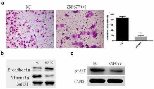 Figure 5. Ectopic expression of ZNF677 suppresses invasion and EMT of 786–0 cells through the inactivation of the PI3K/AKT signaling pathway. (a) Ectopic expression of ZNF677 inhibited 786–0 cell invasion in vitro evaluated by transwell assay. (b) Changes in EMT-related markers between control group cells and ZNF677(+) group cells, measured by Western blot analysis. (c) Changes in p-AKT protein expression between control group cells and ZNF677(+) group cells, measured by Western blot analysis.