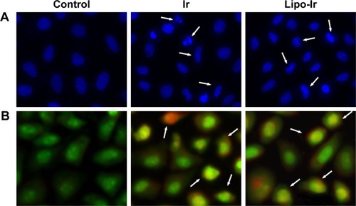 Figure 1 The morphology of apoptosis in A549 cells stained with Hoechst 33342 (A) and AO/EB (B) after treating with 3 μM Ir and equivalent Lipo-Ir for 24 h.Notes: The photographs were imaged using 40× objectives with DAPI (blue) or FITC (green) and Texas Red (red) filters. Arrows show the apoptotic body, chromosome aggregation, or apoptotic cells.Abbreviations: Ir, iridium; Lipo-Ir, Ir-loaded PEGylated liposomes; PEG, polyethylene glycol; AO/EB, acridine orange/ethidium bromide.