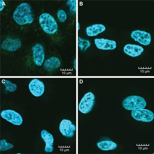 Figure 2 GNP-HC uptake by MSTO-211H and A549 cell lines.Notes: Internalization of functionalized nanoparticles (green signal) was detected in MSTO-211H (A) but not in A549 (C) cells by confocal microscopy. Inert GNP-PEG, marked with the same fluorochrome, were not captured by MSTO-211H (B) or A549 (D) cells. Nuclei of cells were labeled with DAPI (blue signal). Original magnification: 60×. Scale bar =10 μm.Abbreviations: GNP, gold nanoparticle; GNP-HC, anti CD146 coated gold nanoparticles.