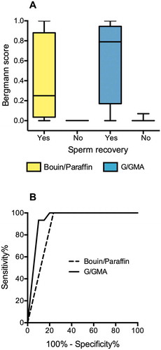 Figure 4. Quantitative Results. (A) Spermatogenesis scores assigned to paired fragments of testicular biopsies (n = 21) processed with Bouin/paraffin (B/P, yellow bars) or glutaraldehyde/glycol methacrylate (G/GMA, blue bars). The cases are divided according to the recovery of sperm for ICSI. (B) Receiver operating characteristics (ROC) curves of spermatogenesis score to predict sperm recovery for ICSI. The curves represent the scores assigned to biopsies processed by B/P or by G/GMA
