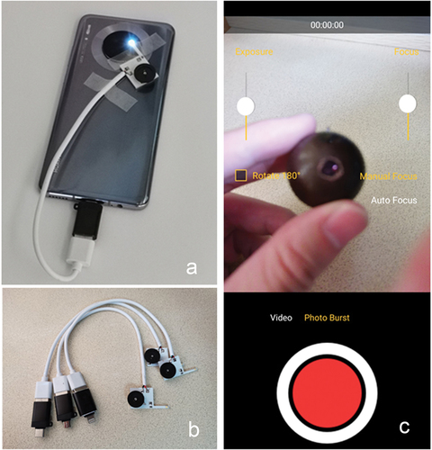 Figure 1. Smartphone ophthalmoscope.