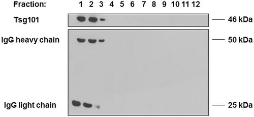Figure 2. Characterisation of immunoglobulins and Tsg101 expression in OKT3 exosomes after purification by sucrose gradient. After isolation from OKT3 cells culture medium, exosomes were loaded on 30%/D2O sucrose gradient and subsequently analysed by Western Blot. Heavy and light chain of immunoglobulins were detectable in the same fractions of Tsg101.
