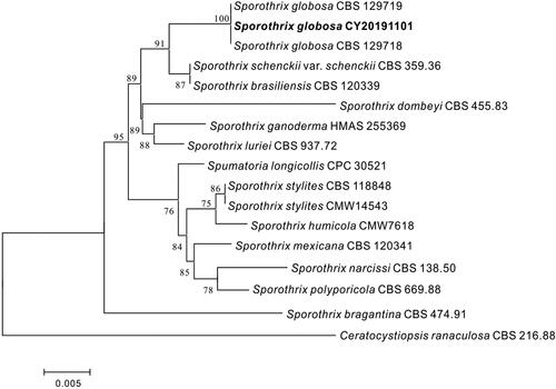 Figure 4 Phylogenetic tree showed that our identified strain named as CY20191101 was 100% of the homology to Sporothrix globosa CBS129719 and CBS 129718.