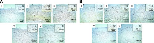 Figure 10 Immunostained rat-paw skin against TNF-α.Notes: (A) Thin skin and (B) thick skin. (I) Normal group showing negative staining, (II) positive control exhibiting strong staining, (III) rats pretreated with 100 mg/kg Dcn showing moderate staining, (IV) and (V) rats pretreated with 1:10 Dcn:Glc SNEDDSs or 1:8 Dcn:TPGS SNEDDS, respectively, exhibiting mild staining. IHC counterstained with Mayer’s hematoxylin (100×); insert (S, 200×).Abbreviations: TNF-α, tumor necrosis factor-alpha; Dcn, diacerein; Glc, gelucire 44/14; TPGS, d-α-tocopheryl polyethylene glycol 1,000 succinate; SNEDDS, self-nanoemulsifying drug-delivery system; IHC, immunohistochemically.