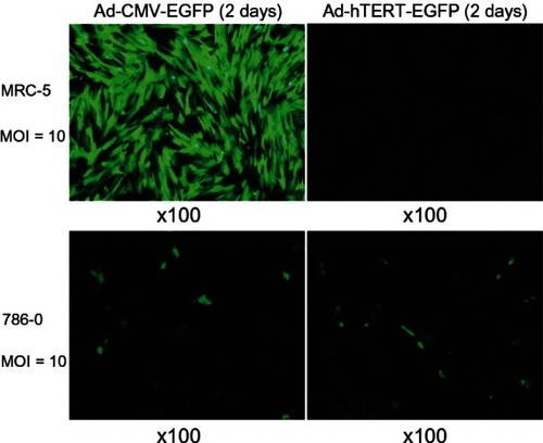 Figure 1 Expression of adenovirus cytomegalovirus-enhanced green fluorescent protein (Ad-CMV-EGFP) and Ad-human telomerase reverse transcriptase (hTERT)-EGFP in MRC-5 and 786-0 cells.