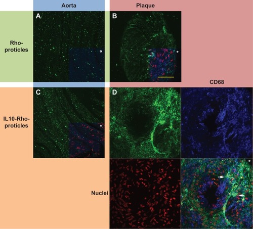 Figure 3 The staining signal of IL10 coated protamine- and oligonucleotide-based NPs, detected on atherosclerotic-plaques and compared to controls.Notes: Aortic sections of ApoE-deficient mice were incubated with rhodamine-labeled proticles for control (A) and (B), or coated with IL10 (C) and (D); NP signals are shown in green. Less-injured aortic areas are shown in (A) and (C) (blue area), atherosclerotic-plaques in (B) and (D) (red area). All images are depicted merged with co-stainings for CD68 (macrophages) shown in blue and for the nuclei shown in red (*all; °without nuclei); images of the IL10-Rho-proticles stained plaque are also shown split. IL10-Rho-proticles were found to partially co-localized with CD68 positive macrophages (arrows pointing to the bluish-green color). Bar indicates 50 μm.Abbreviations: IL10, interleukin 10; NPs, nanoparticles; AS, atherosclerotic; ApoE, apolipoprotein E; Rho, rhodamine.