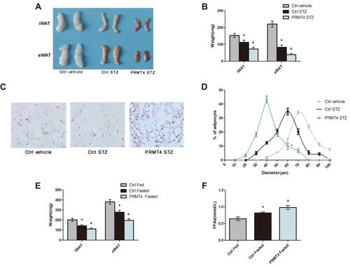 Figure 2 PRMT4 overexpression promotes lipolysis in mice.Notes: (A–D) Lipolysis was tested in mice with streptozotocin (STZ)-induced diabetes and in control mice. The gross morphology of the fat pads (A) and the tissue weights (B) of the inguinal white adipose tissue (iWAT) and epididymal white adipose tissue (eWAT) were recorded. Representative images of H&E-stained sections of eWAT (C), and frequency distribution of the adipocyte sizes of eWAT (D). (E and F) Weights of the iWAT and eWAT (E) and levels of serum-free fatty acids (FFAs) (F) determined in adeno-associated virus (AAV) control-infected fed mice (Ctrl-Fed), AAV-control-infected fasted mice (Ctrl-Fasted), and AAV-PRMT4-infected fasted mice (PRMT4-Fasted). *P < 0.05 indicates a significant difference between the Ctrl-STZ and Ctrl-vehicle groups or the Ctrl-Fasted and Ctrl-Fed groups. #P < 0.05 indicates a significant difference between the PRMT4-STZ and Ctrl-STZ groups or the PRMT4-Fasted and Ctrl-Fasted groups.