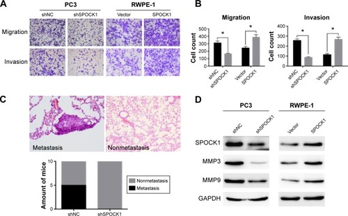 Figure 6 SPOCK1 promoted metastasis in prostate cancer.