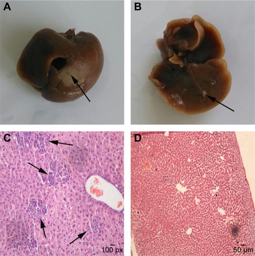 Figure 5 Baicalein suppresses liver metastasis of breast cancer in vivo.