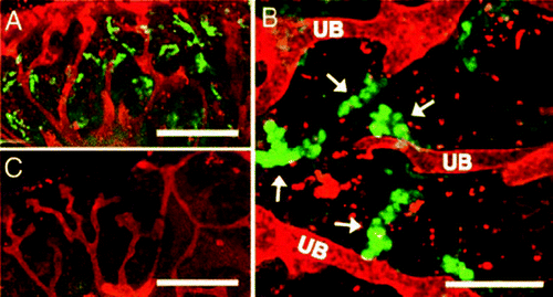 Figure 7 (A–C) Confocal fluorescent micrographs of kidney-like tissue engineered from the recombination of cultured UB (red—UB-derived tubules are stained with TRITC-conjugated D. biflorus,) and freshly isolated metanephric mesenchyme (7 days after recombination). The accumulation of 6-CF (green—a fluorescent organic anion which is transported via the basolaterally localized organic anion transporters of the proximal tubule) in the MM-derived tubules of the recombined tissue indicates that structural and functional differentiation of the mesenchyme is occurring. (B and C) The accumulation is seen only in the cells of non-UB-derived tubules (arrows) and is inhibited by probenecid- (a competitive inhibitor of organic anion transport) [Scale bars: (A and C), 500 µm; (B), 200 µm]. (From ref. Citation20).