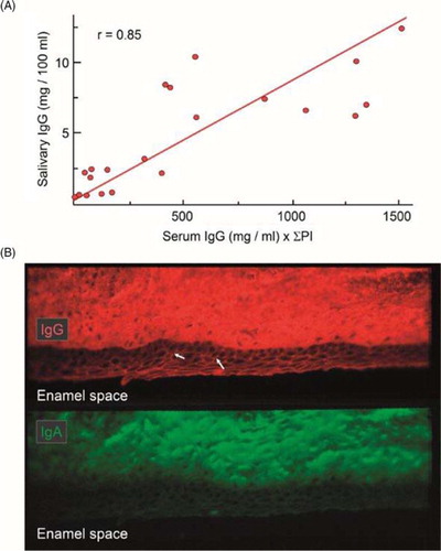 Fig. 3 Distribution of serum IgG in whole saliva and crevicular epithelium. (A) Regression line for the relationship between concentrations of IgG in whole saliva and the corresponding serum concentrations multiplied by the sum of the individual's periodontal index (PI) scores. Adapted from Brandtzaeg et al. (Citation13). (B) Immunofluorescence demonstration of IgG (red) and IgA (green) in monkey gingiva that had been directly alcohol-fixed in situ before being removed from the tooth. Middle part of the crevicular epithelium is shown. IgG and IgA permeate the connective tissue and particularly IgG appears intercellularly in the epithelium (arrows) (original magnification: ×125). Unpublished experiments (Brandtzaeg P and Tolo K).