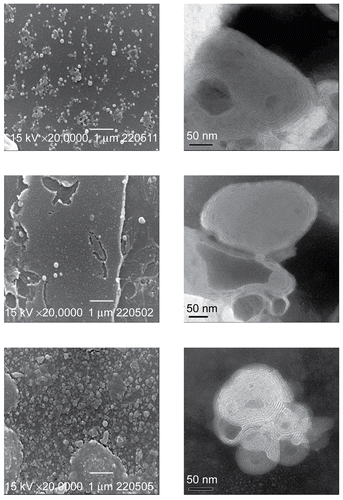 Figure 1.  SEM (left) and TEM (right) images of ACV-lip (top), ManN-ACV-lip (middle), and PAM-ACV-lip (bottom).