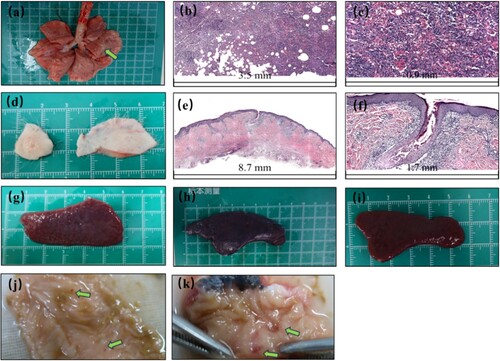 Figure 6. The following organ lesions and histopathological changes were observed in cynomolgus macaques infected with WIBP-MPXV-001. (a-c) Interstitial pneumonia was characterized by a decrease in alveolar space and the presence of a large number of inflammatory cells in the alveolar septa. The pathology of 186503C is shown in (b) at 5× magnification and in (c) at 20× magnification. The tissue sections were stained with hematoxylin and eosin (H&E) to visualize the cellular structures. (d-f) Lesions at the injection site, including skin damage, redness, and infiltration of a large number of mononuclear cells and lymphocytes in the dermis of 186503C, are shown in (e) at 2× magnification and in (f) at 10× magnification. H&E staining was performed to visualize the changes in tissues. (g-i) Splenomegaly. Animals had enlarged spleens without apparent lesions. From left to right, the images represent the spleens of 186503C, 179327C, and 186321C, respectively. (j-k) Hemorrhagic spots in the colon and ulcerative lesions in the rectum of 179327C.