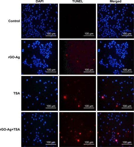 Figure 14 Effects of rGO-Ag alone or TSA alone or in combination on apoptosis in SKOV3 cells.Notes: SKOV3 cells were treated with rGO-Ag (0.2 µM) alone, TSA (0.2 µM) alone, or combination of both rGO-Ag (0.2 µM) and TSA (0.2 µM) for 24 h. Apoptosis was assessed by TUNEL assay; the nuclei were counterstained with DAPI. Representative images show apoptotic (fragmented) DNA (red staining) and the corresponding cell nuclei (blue staining).Abbreviations: rGO-Ag, reduced graphene oxide-silver; TSA, trichostatin A; TUNEL, terminal deoxynucleotidyl transferase-mediated dUTP nick end labeling.