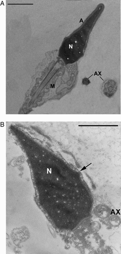 Figure 6.  TEM micrographs of longitudinal sections of sperm. A) sperm with a normally shaped acrosome (A) with regular size and compact content present in a normal position and with a regularly shaped nucleus (N) with condensed chromatin. Mitochondria (M) have a regular shape and are organized in a normal helix. Cross sections of normal flagella with a 9 + 2 axonemal pattern (AX) are also present. B) necrotic sperm with broken plasma membrane (arrow), nucleus (N) with disrupted chromatin and without acrosome. The axoneme (AX) and periaxonemal structures of the tail are degraded. Bar 1 µm.