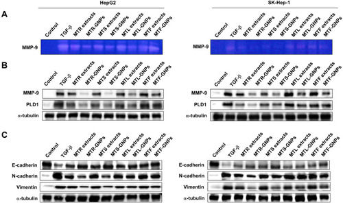 Figure 6 Downregulation of MMP-9, PLD, and other EMT-related proteins by MTR-, MTS-, MTL-, and MTF-GNPs.Notes: (A) MMP-9 enzymatic activity was detected by gelatin zymography. (B) Effect of MTR-, MTS-, MTL-, and MTF-GNPs on the expression of MMP-9 and PLD1 proteins. (C) Effect of MTR-, MTS-, MTL-, and MTF-GNPs on the protein expression of E-cadherin, N-cadherin, and vimentin. Control is non-treated group.Abbreviations: MMP-9, matrix metalloproteinase-9; PLD, phospholipase D; TGF-β, transforming growth factor-beta; MTR-, MTS-, MTL-, and MTF-GNPs, Maclura tricuspidata root-, stem-, leaf-, and fruit-extract-gold nanoparticles, respectively.