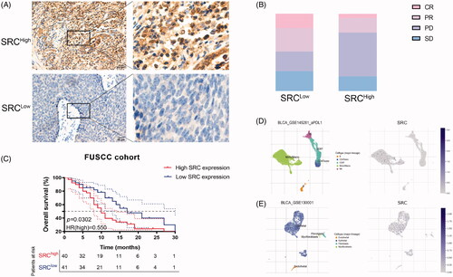 Figure 9. SRC protein expression significantly predicts immunotherapy responses for 81 BCa patients from FUSCC cohort. (A) Immunohistochemistry was performed and SRC was mainly stained in plasma membrane and cytosol. (B) Elevated SRC protein expression significantly correlated with poorer survival in 81 BCa patients receiving ICT. (C) There are 32% PR (n = 14), 18% CR (n = 8), 25% SD (n = 11) and 25% PD (n = 11) cases in low SRC expression subgroup, and 19% PR (n = 7), 5% CR (n = 2), 19% SD (n = 7) and 57% PD (n = 21) cases in high SRC expression subgroup. (D and E) The single-sequencing dataset GSE145281 and 130001 suggested localization and binding targets of SRC mainly in monocyte/macrophages and epithelial cells.