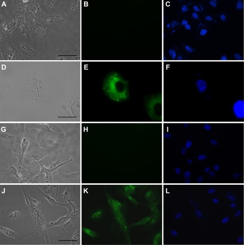 Figure 2 In vitro uptake of 5 μM gH625.Notes: The left column shows images acquired with differential interference contrast, the central column with the fluorescein isothiocyanate channel, and the right column with the 4′-6-diamidino-2-phenylindole channel. Each row represents the same field. (A–C) Negative controls for SH-SY5Y cells. (D–F) SH-SY5Y cells treated with gH625. (G–I) Negative controls for U-87 MG cells. (J–L) U-87 MG cells treated with gH625. Scale bars correspond to 50 μm, except for (D–F) where they correspond to 20 μm.