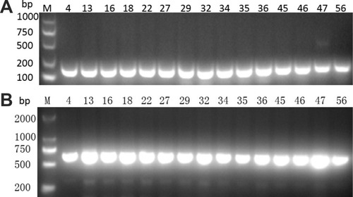 Figure 1 Presence of (A) Cas1 and (B) Cas3 genes by PCR. M indicates the DNA marker. The numeric characters represent the sequential number of different K. pneumoniae isolates.