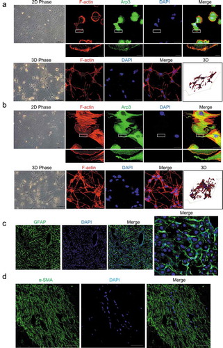 Figure 1. Cell morphology of hepatic stellate cells (HSCs). (a and b). Human LX-2 HSCs (A) and rat HSCs (B) cultured on a 2D polystyrene surface (2D PS) showed a flattened morphology without cellular processes and were spread out with well-developed lamellipodia and actin stress fibers (top). LX-2 cells and rat HSCs were stained with rhodamine-conjugated phalloidin (F-actin), an antibody against Arp3 (a marker of lamellipodia) and DAPI (nuclear DNA). Human LX-2 HSCs (A) and rat HSCs (B) cultured in 3D floating collagen matrices (3D FCM) exhibited stellate or dendritic morphologies and long, slender cellular processes (bottom). LX-2 cells and rat HSCs cultured in 3D FCM were stained with rhodamine-conjugated phalloidin (F-actin). Images were photographed ≥ 150 μm away from the surface with a confocal microscope. (c). Immunofluorescence staining for GFAP (green) in the liver tissues from mice injected with CCl4 revealed that the GFAP-positive cells, HSCs, had expanded extended cellular processes along the sinusoids, which is similar to the phenotype in 3D FCM. (d). Immunofluorescence staining for α-SMA (green) of activated HSCs in human fibrosis liver showed long cellular processes along the fibrotic septa. Scale bars = 40 and 5 μm (insets).