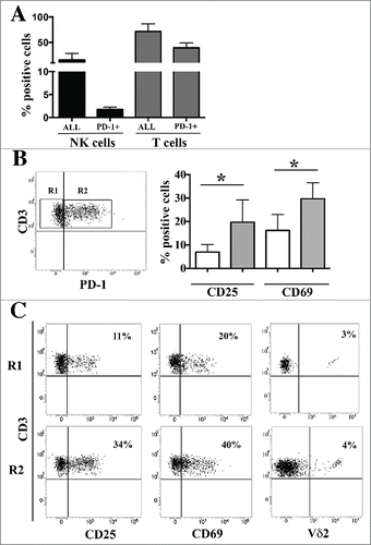 Figure 5. Surface expression of PD-1 in lymphocytes from NB-infiltrated bone marrow aspirates of patients with stage M. Panel A: Bone marrow infiltrating NK and T cells were analyzed by multicolor flow cytometry. The percentage of the two lymphocyte populations and of the PD-1pos subsets is shown. Mean and 95% confidence intervals are indicated. Panel B: Gating strategy (left) and CD25 and CD69 expression (right) in CD3pos PD-1neg (R1, white bars) and CD3pos PD-1pos (R2, gray bars) T cells. Mean of percentage of positive cells, MFI and 95% confidence intervals are indicated. * p < 0 .05. Panel C: Representative cytofluorimetric analysis of CD25, CD69 and Vδ2 expression in CD3pos PD-1neg (R1) and CD3pos PD-1pos (R2) T cells. Percentage of positive cells and MFI are indicated.