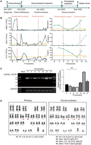 Figure 1. Clinical presentation of the patient with the CNTRL::FGFR1 fusion. (A) Schematic representation of the treatment course of the patient with the CNTRL::FGFR1 fusion. (B) Peripheral WBC counts, ANC, PLT, peripheral blood and bone marrow blast cell percentage, FISH positive signal before and during treatment with olverembatinib. (C) QRT-PCR analysis from patient bone marrow samples before and during therapy with olverembatinib. A fragment of a 635 bp unique CNTRL::FGFR1 fusion sequence was amplified. A mock RT-PCR reaction with water was included as controls. (D) Cytogenetic analyses showed the reciprocal translocation t(8;9) (p11.2;q33.2) and complex abnormalities. **p < 0.01. PR: partial remission; McyR: major cytogenetic response; WBC: white blood cell; ANC: absolute neutrophil counts; PLT: platelet counts; FISH: fluorescence in situ hybridization; QRT-PCR: Quantitative real-time polymerase chain reaction.