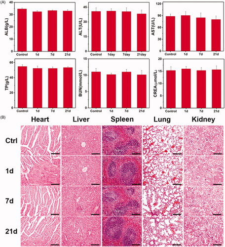 Figure 9. In vivo toxicity tests of Gd-MFe3O4 NPs: (A, a–f) mouse serum biochemistry analysis before (0d, control) and after injection of NPs for 1, 7, and 21 days. (B) Histological images of the heart, liver, spleen lung, and kidney of healthy mice 1, 7, and 21 days injected with Gd-MFe3O4 NPs and control mice. The organs were sectioned and stained with hematoxylin and eosin (H&E) and observed under a light microscope, scale bar = 100 μm.