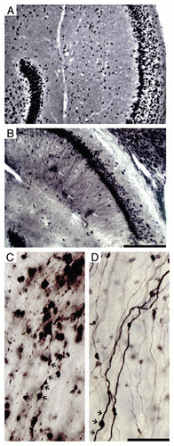 Figure 2 Photomicrographs of hippocampal region of ME7 subjects at 18 w.p.i. after Neu-N (A) and PrP (B) immunohistochemistry to illustrate vacuoles and PrPSc deposits (white arrows) respectively. Photomicrographs of ME7-animal (C) and NBH-animal (D) mossy fibers at 18 w.p.i. Black arrows indicate damaged axons with boutons tumefaction, and reduction of the axonal filling in the ME7 infected brain whereas in the NBH-animal these signs are not present. Scale bars: (A and B) 250 µm; (C and D) 25 µm.