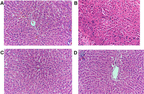 Figure 6 Histopathological changes in rat livers, stained with H&E (200×). (A) The liver slices of normal rats without damage; (B) with CCl4 damaged group; (C) treated with lentinan as positive control group; (D) treated with ARPS group.