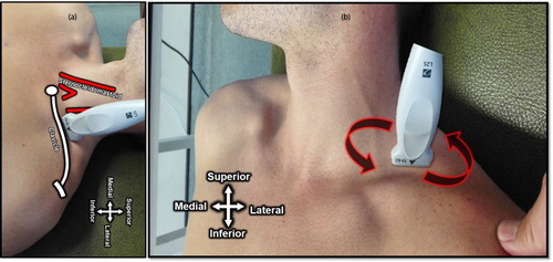 Figure 4: (a) Superior view of the probe placed in the supraclavicular fossa (posterior and approximately parallel to the clavicle). (b) Rotation of the probe for ideal sonoanatomy imaging.