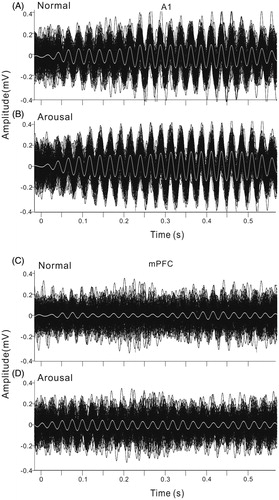 Figure 4. Individual ASSRs of each trial in one session. The same example shown in Figure 3. (A) and (B) ASSR of A1 under normal and arousal condition. Black lines are the individual ASSRs, white line is the averaged ASSR. (C) and (D) ASSR of mPFC under normal and arousal condition.