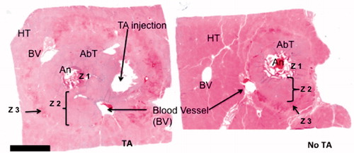 Figure 6. H&E-stained section of porcine liver following in vivo microwave ablation with and without thermal accelerant. Ablation with TA (left) yielded a larger and more elongated ablation zone than without TA (right). An: antenna; AbT: ablated tissue; HT: healthy tissue; BV: blood vessel; Z: zone. A bar below the tissue image represents 5 mm.