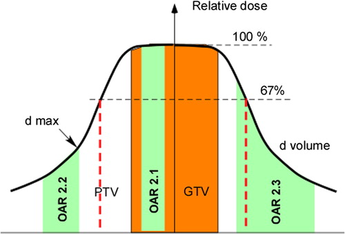 Figure 1. Typical inhomogeneous dose distribution within the PTV as used in SBRT. Numbers in the OARs refer to the different cases described in the three sections of the Material and methods.