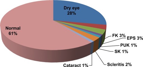 Figure 2 Percentage distribution of ocular manifestations of rheumatoid arthritis among the total study population.