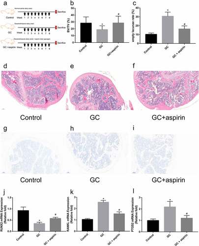 Figure 5. Identification of the therapeutic effect of aspirin in GC-induced ONFH. (a) Schematic diagram of the treatment of different groups of mice. H&E staining of representative femoral heads in each group. (b) Bone volume/total volume ration (BV/TV) in each group. (c) Empty lacunae rate in each group. (d-f) H&E staining of representative femoral heads in each group (scale bar = 100 μm). (g-i) TRAP staining of representative femoral heads in each group (scale bar = 100 μm). (j-l) Relative Runx2, RANKL and PTGS2 mRNA expression in femoral heads in each group. All experiments were performed in triplicate, and the results are presented as the means ± SD. (*p < 0.05 versus the control; #p < 0.05 versus the GC)