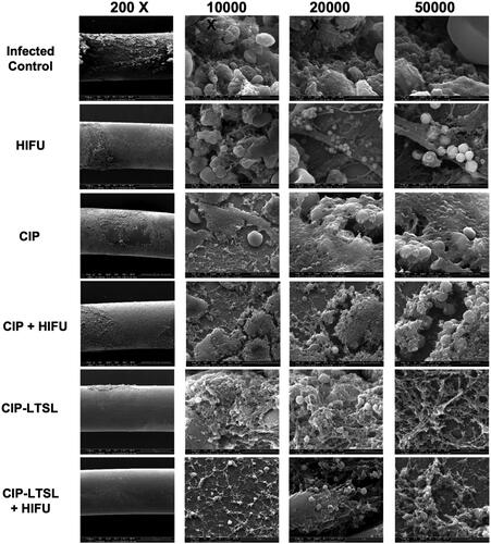 Figure 7. Scanning electron microscopy (SEM) used to observe the effect of CIP-LTSL + HIFU treatments on biofilm-contaminated wire explants taken from infected bones showed a reduction in bacterial burden relative to other groups. The analysis was conducted on a single specimen (n = 1).