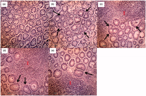 Figure 2. (a) Normal histoarchitecture of rat colon; (b) AOM control group; (c) section of colon tissue treated with AOM + 50 mg/kg MEMC; (d) section of colon tissue treated with AOM + 250 mg/kg MEMC; (e) section of colon tissue treated with AOM + 500 mg/kg MEMC (I – Infiltration of inflammatory cells. Black arrow – Aberrant crypt foci) (100 × magnification).