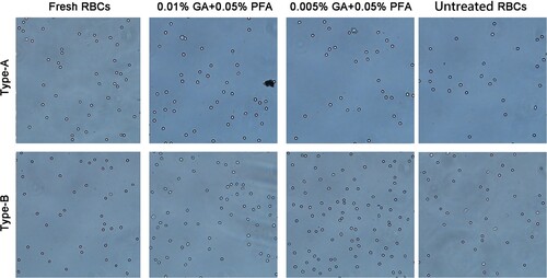 Figure 6. The dispersion of red blood cells after six months of storage. At the sixth month, various concentrations of GA/PFA treated red blood cell reagents exhibited good dispersibility under the microscope, with no agglutination or cell overlap.