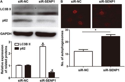 Figure 3. Effect of SENP1 on the autophagy of HUVECs transfected with siR-NC and siR-SENP1. (A) Expression of autophagy markers, LC3B II and p62 proteins, in HUVECs transfected with siR-NC and siR-SENP1, as determined by Western blotting. *, p < .05 compared with siR-NC group for the same protein. (B) Number of autophagosomes in HUVECs transfected with siR-NC and siR-SENP1, as determined by laser scanning confocal microscopy. *, p < .05.