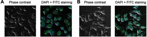 Figure S1 The expression of vWf and CD31 on endothelial cells was confirmed by the immunofluorescence assay. The cells were treated with the first antibodies (anti-rat vWf and anti-rat CD31 antibodies), and treated with FTIC-labeled anti-rabbit secondary antibodies. 4’,6-diamidino-2-phenylindole (DAPI) was used to stain the nuclei. (A) vWf staining. (B) CD31 staining. Bars represent 10 μm