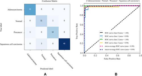 Figure 11 Test results of EfficientNetB0 model for cervical cancer type classification (A) Confusion matrix (B) ROC-AUC plot (0: adenocarcinoma, 1: normal, 2: precancer and 3: squamous cell carcinoma, respectively).
