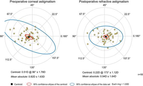 Figure 5 Double-angle plot showing preoperative and postoperative astigmatic vectors and their means and spread for the cataract surgery–only group.